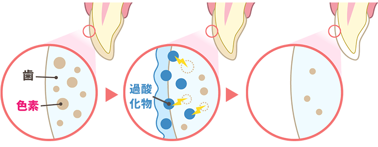 ホワイトニングの仕組み