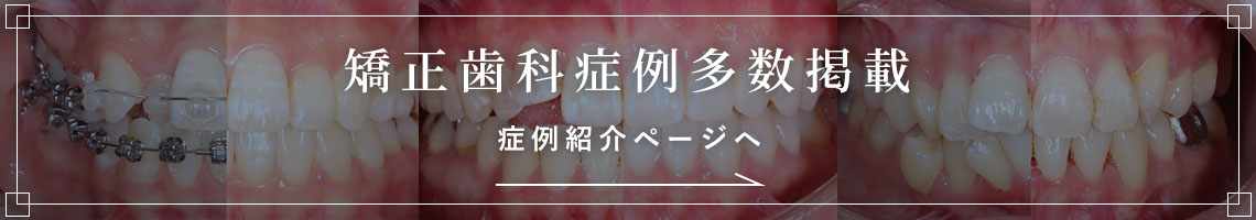 矯正歯科症例紹介