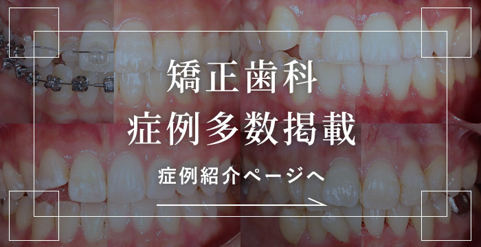 矯正歯科症例紹介