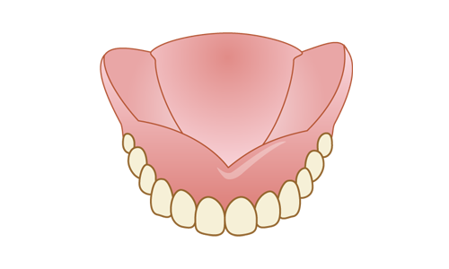 総入れ歯（総義歯）