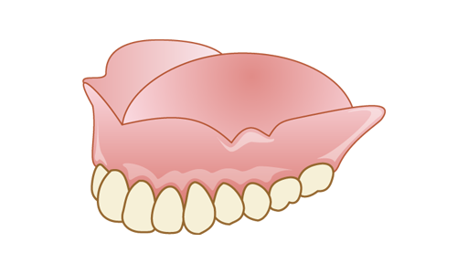 レジン床義歯（保険適用）