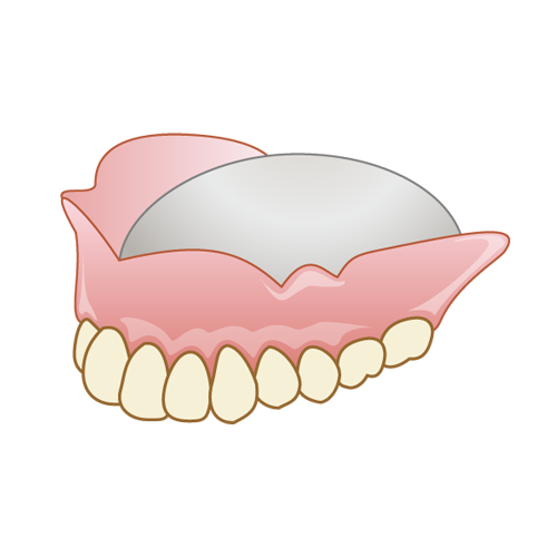 金属床義歯（自費診療）
