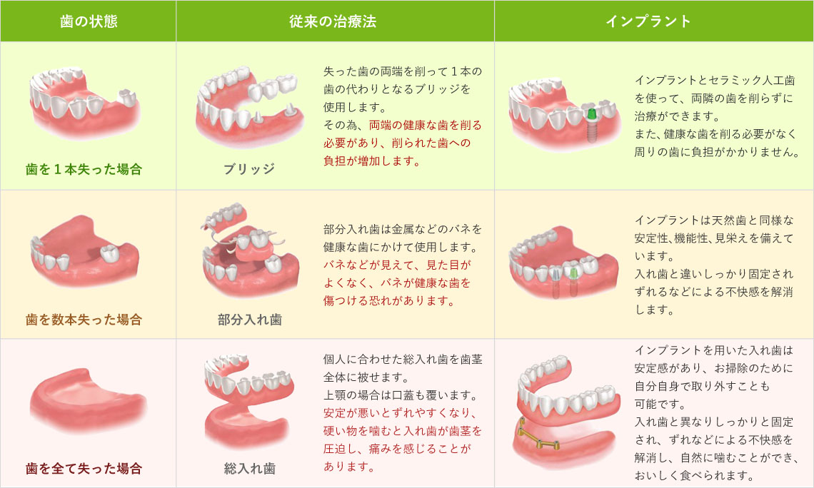 インプラントと従来の治療法の比較