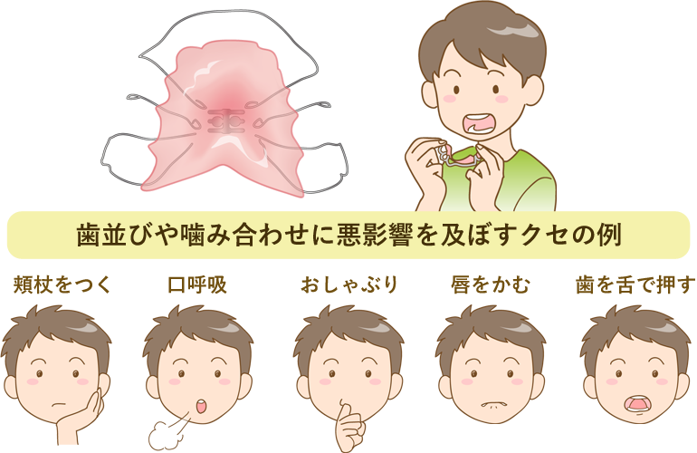 第１期矯正治療