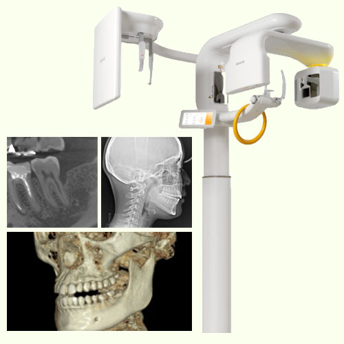 歯科用CT